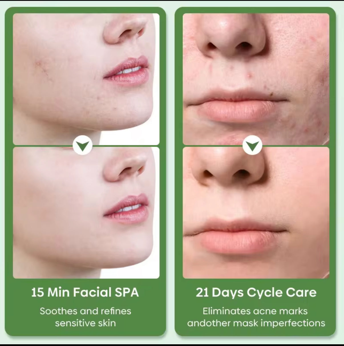 Green Tea Eggplant Facial Clay Mask Stick
Purifying Deep Cleansing Removal Blackheads Acne
Anti Blemish Cleanser Stick for Face